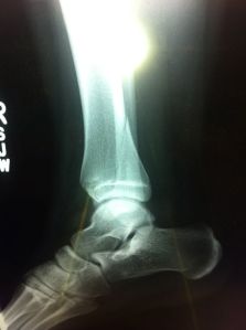 Det handlade om ett brott.